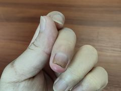 -世龙世家甲沟炎·灰指甲·嵌甲矫正·修脚(武侯区双楠店)