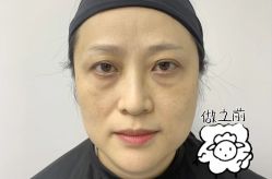 -广州健丽·去眼袋医疗美容机构