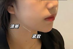 -上海伊莱美医疗美容医院