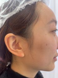 -长沙雅美医疗美容医院