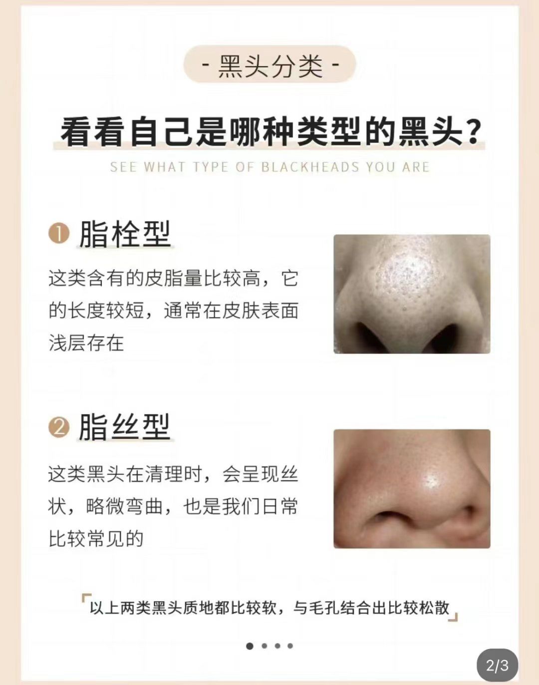看看自己是哪种类型的黑头?
脂栓型