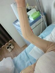 体验后-禾美嘉医疗美容