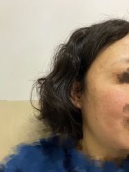 -荟草堂专业痘肌皮肤管理