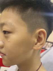 -北京美痣堂古方祛痣斑疣瘊