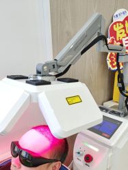 -大麦微针植发全国连锁