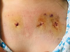 -中国人民解放军总医院第三医学中心