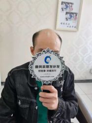 -唐风采假发补发定制