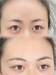 点击看大图 -张小野·专业半永久纹眉