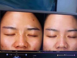 点击看大图 -苑苑vbeauty科技美容SPA