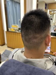 -大麦微针植发全国连锁