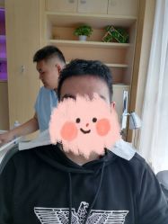-大麦微针植发丨全国连锁
