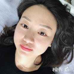 -西施无菌半永久纹绣眉眼影唇轻增发纹发际线