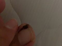 -Andrew指甲专科灰指甲·甲沟炎矫正·3D步态矫形鞋垫定制(上海法华镇路旗舰店)