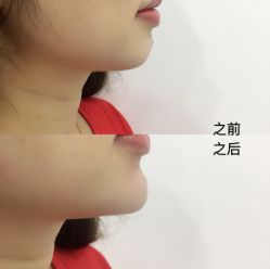 点击看大图 -贞禾医美·连锁