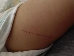 -首都医科大学附属北京潞河医院