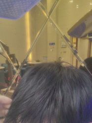 -碧莲盛·不剃发植发