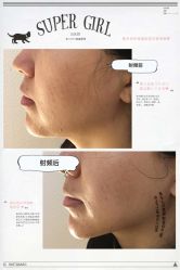 小v脸-光SPA科技美肤