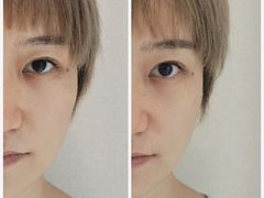 -FACE·日本小颜美容整骨(福田店)