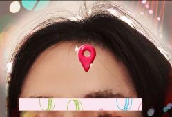 -大麦微针植发全国连锁