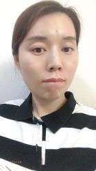 -More摩尔医美の注射线雕光电中心