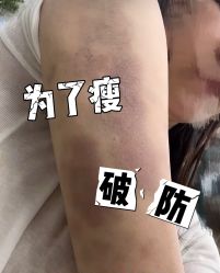 -Fundi张玉珊修身堂·indiba·BTL科技瘦身