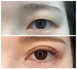 -西安伊美尔医疗美容医院