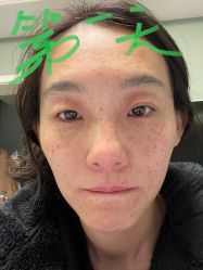 -八大处整形