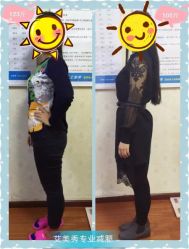 -维纳斯专业减肥