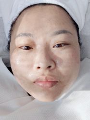 -悟空祛痘·诺奖技术专业店