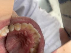 -宁波壹加壹口腔·矫正种植中心