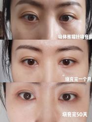 -上海漾颜医疗美容