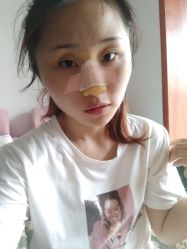 点击看大图 体验后-鑫元辰医疗美容整形