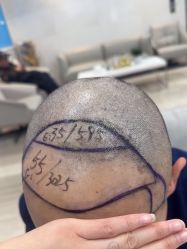 -雍禾植发全国连锁