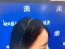 -雍禾植发全国连锁