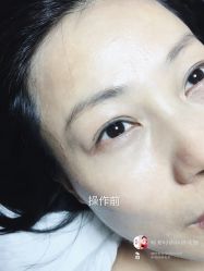 点击看大图 -西施无菌半永久纹绣眉眼影唇轻增发纹发际线
