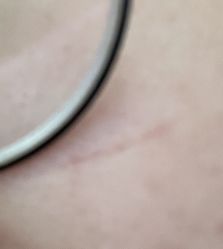 -苑苑vbeauty科技美容SPA