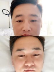 -MIVI半永久纹眉纹绣