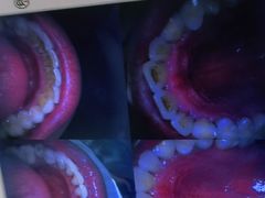 -爱牙联合口腔(门诊报销 海云庵店)