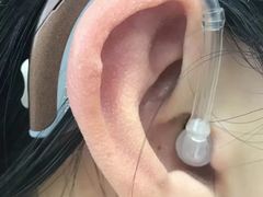 -惠耳听力助听器(霍邱新蓼大道店)