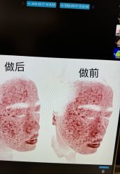-skin79皮肤管理中心