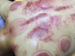 -沈师傅盲人按摩工作室(密三小区店)