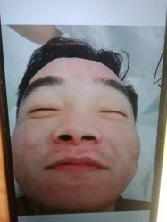 点击看大图 -蕾特恩·专业祛痘国际连锁