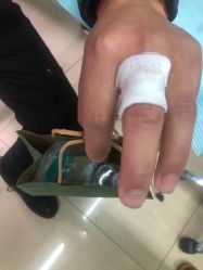 -秦好山专业洗纹身