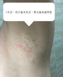 -一美医疗美容