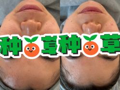 -skin79皮肤管理中心