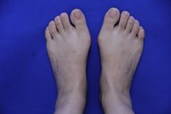 体验前-圣嘉新医疗美容医院