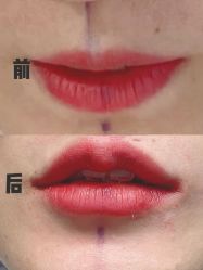 -上海漾颜医疗美容