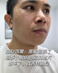 体验后-科佳医疗美容·轻医美