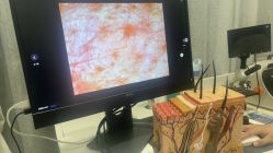 -悟空祛痘·诺奖技术专业店