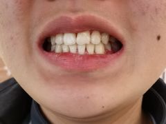 -齐玉齿科JADENTAL